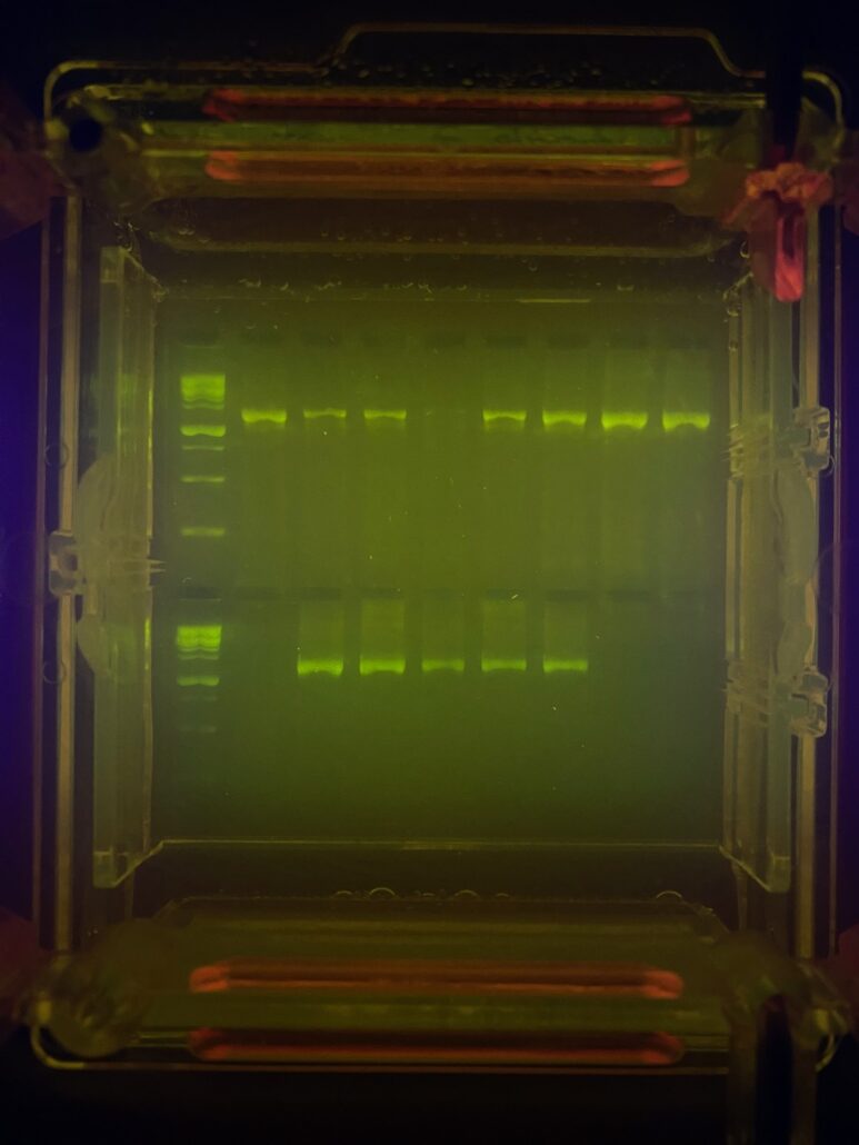 gel electrophoresis results